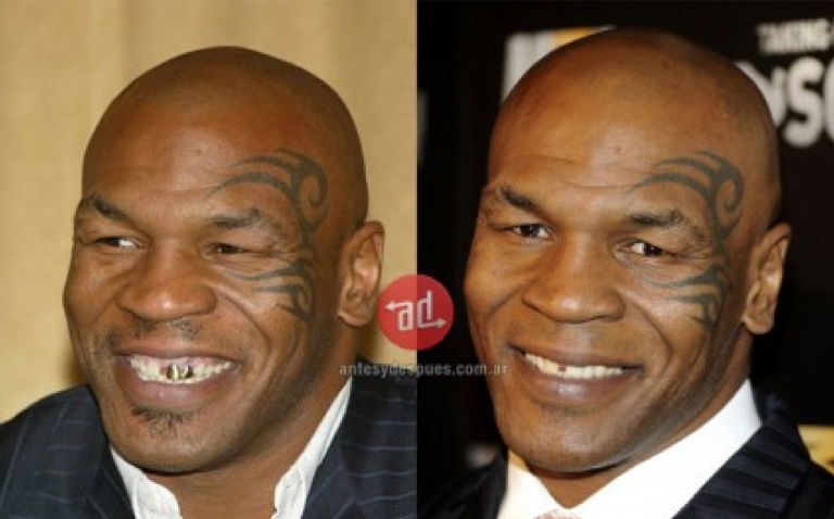Mike tyson