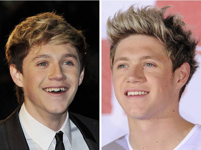 Niall horan